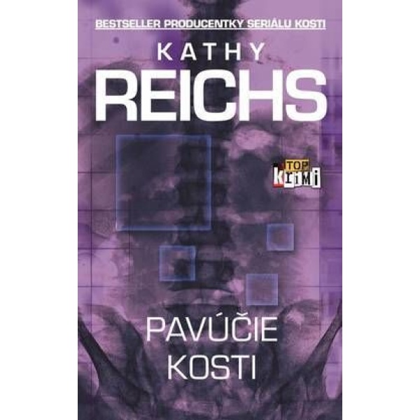 Pavúčie kosti - Kathy Reichs